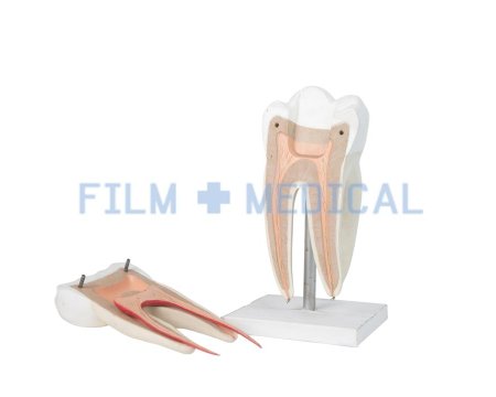 Tooth Model on Stand 